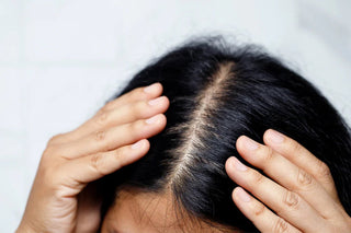 Haarverlies vs. shedding: wat is het verschil en wat kan je eraan doen? - Veganboost