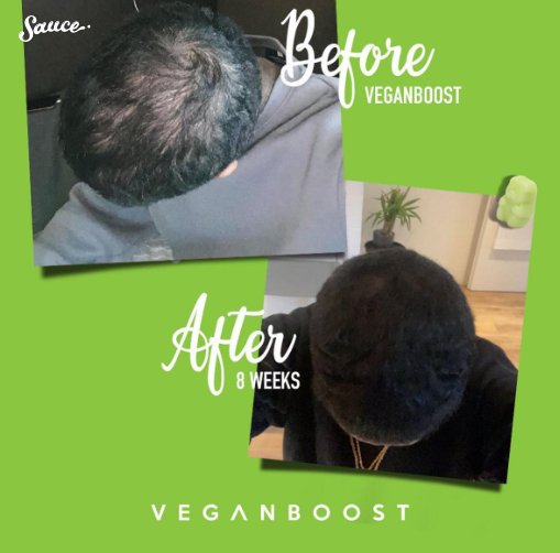 Je hoofdhuid verzorgen, zo doe je dat! - Veganboost