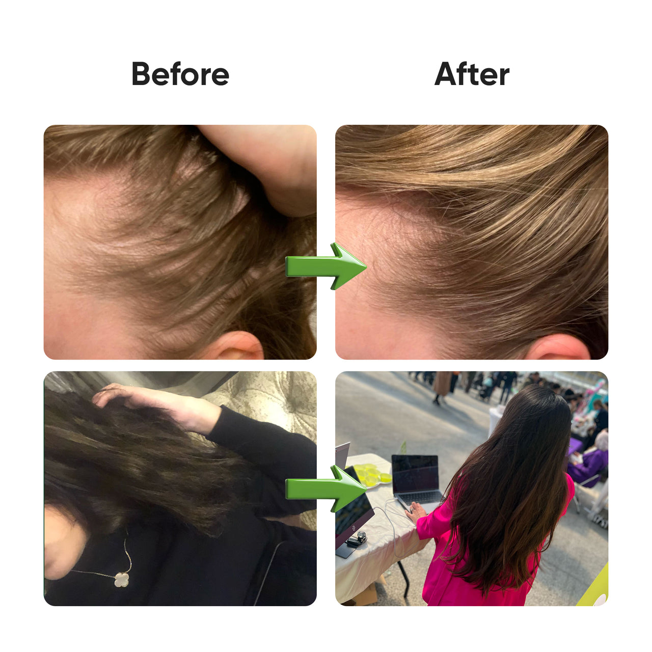 Hair Vitamins Apple