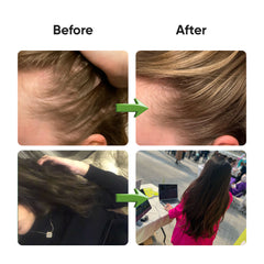Hair Vitamins Watermelon